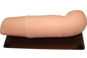 Subcutaneous embedded contraception arm